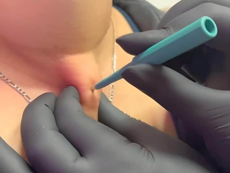 Dermal piercing at Flesh Body Piercing